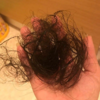 Hair Fall